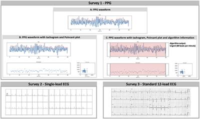 Accuracy of Physicians Interpreting Photoplethysmography and Electrocardiography Tracings to Detect Atrial Fibrillation: INTERPRET-AF